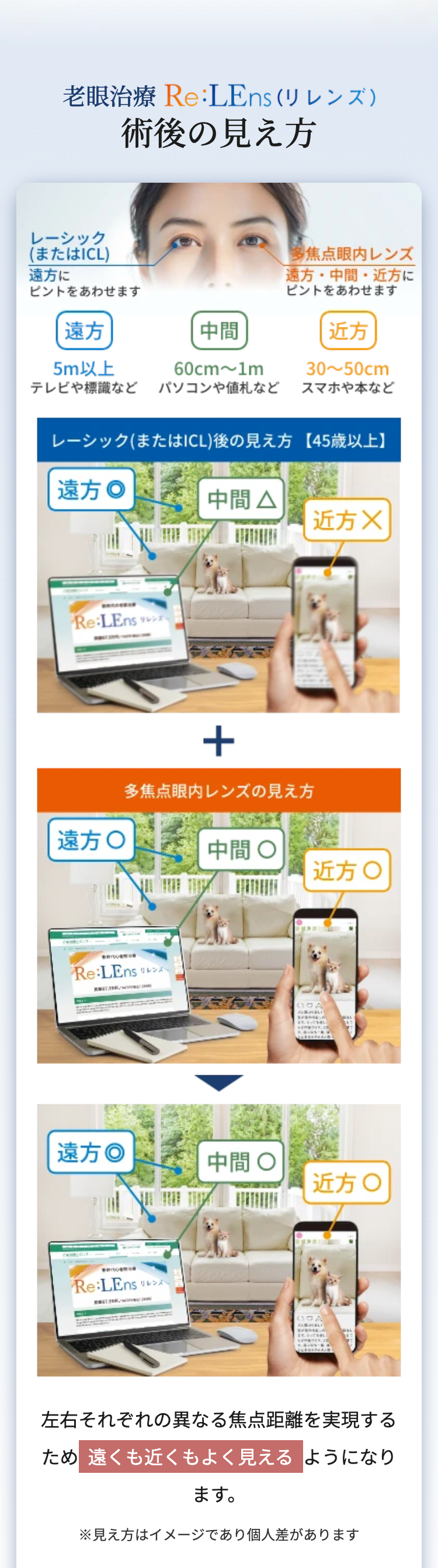 老眼治療 Re:LEns (リレンズ)
術後の見え方
レーシック
(またはICL)
遠方に
ピントをあわせます
遠方
中間
多焦点眼内レンズ
遠方・中間近方に
ピントをあわせます
近方
5m以上
60cm~1m
テレビや標識など パソコンや値札など
30~50cm
スマホや本など
レーシック (またはICL)後の見え方 【 45歳以上】
遠方
Re:LEns リレンズ
中間
△
近方×
+
多焦点眼内レンズの見え方
遠方○
中間O
近方〇
b
Re:LEns リレンムー
い
SEME
遠方◎
中間O
近方〇
Berbe
Re:LEns
STMIR JH
左右それぞれの異なる焦点距離を実現する
ため遠くも近くもよく見えるようになり
ます。
※見え方はイメージであり個人差があります