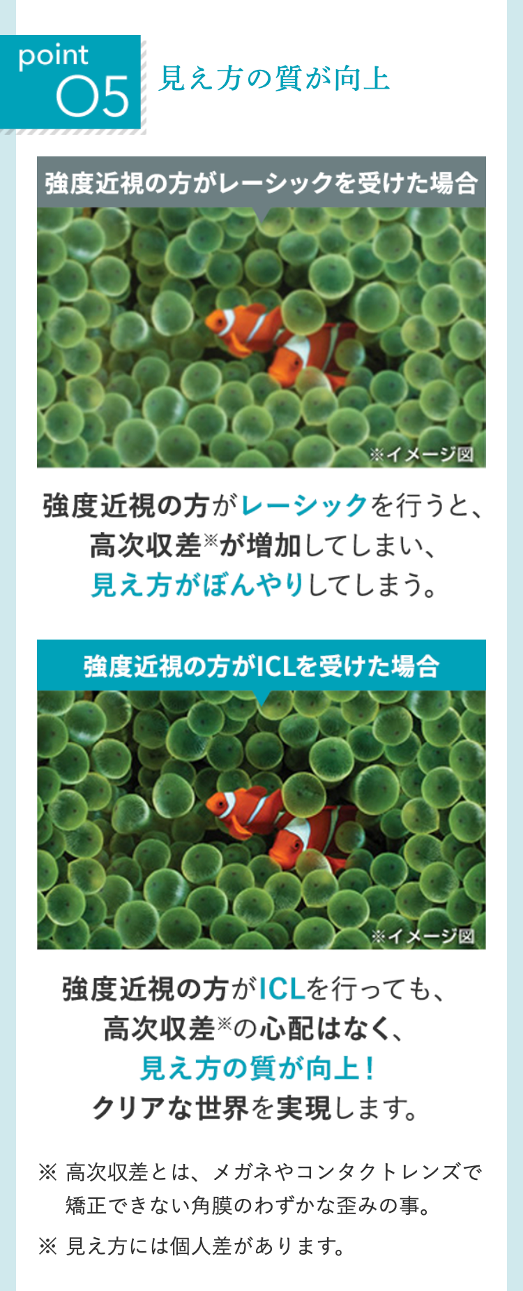 point
O5
見え方の質が向上
強度近視の方がレーシックを受けた場合
※イメージ図
強度近視の方がレーシックを行うと、
高次収差が増加してしまい、
見え方がぼんやりしてしまう。
強度近視の方がICLを受けた場合
※イメージ図
強度近視の方がICLを行っても、
高次収差の心配はなく、
見え方の質が向上!
クリアな世界を実現します。
※ 高次収差とは、メガネやコンタクトレンズで
矯正できない角膜のわずかな歪みの事。
※ 見え方には個人差があります。